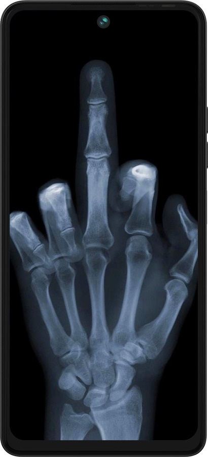 Силіконовий чехол Рука через рентген для Tecno Pova 5 - 1007u-3139 изображение 