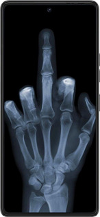 Силіконовий чехол Рука через рентген для Tecno Pova 6 Pro - 1007u-3689 изображение 