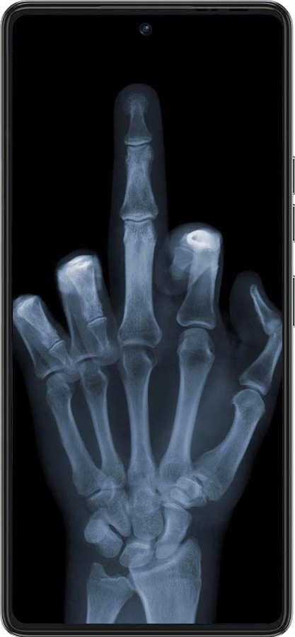 Силіконовий чехол Рука через рентген для Tecno Pova 6 Pro - 1007u-3689 изображение 