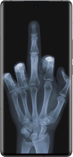 Силиконовый чехол Рука через рентген для Vivo IQOO 12 PRO - 1007u-3420 изображение 