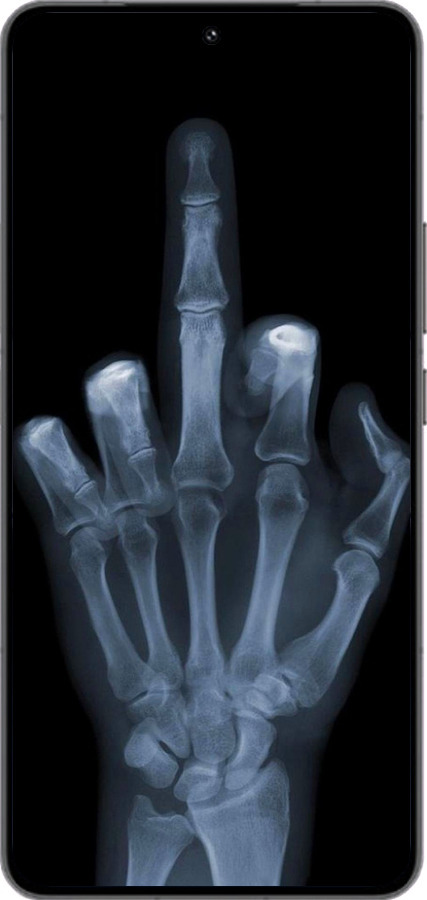 Силиконовый чехол Рука через рентген для Vivo IQOO 13 - 1007u-3913 изображение 