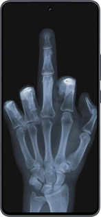 Силиконовый чехол Рука через рентген для Vivo iQOO Neo9 - 1007u-3631 изображение 