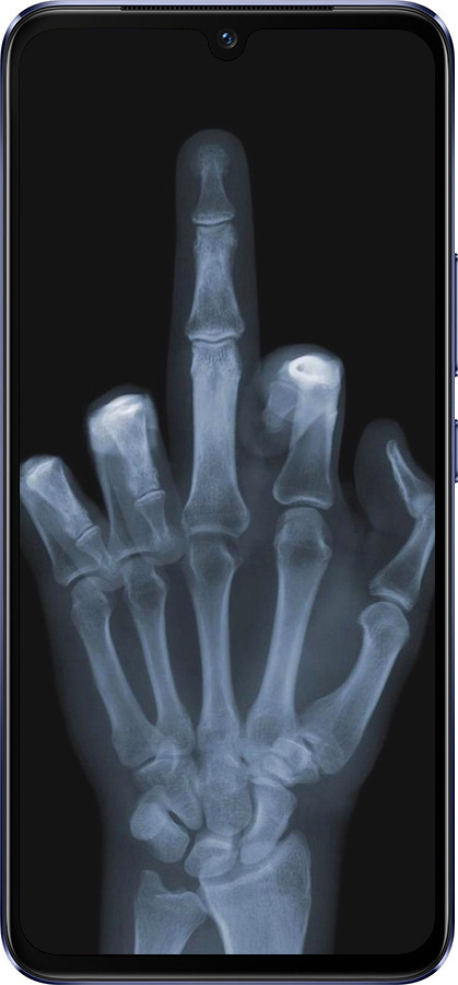 Силіконовий чехол Рука через рентген для Vivo V21 - 1007u-2368 изображение 