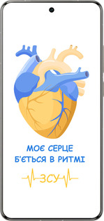 Силіконовий чехол Серце 2  для Vivo X200 PRO - 5296u-3883 изображение 