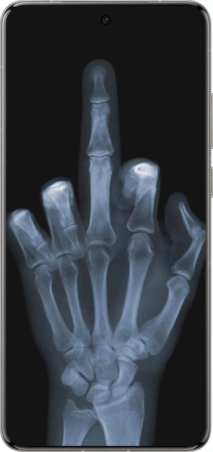 Силиконовый чехол Рука через рентген для Vivo X200 PRO - 1007u-3883 изображение 