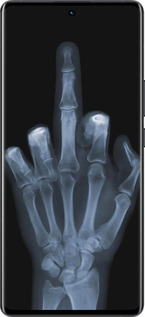 Силиконовый чехол Рука через рентген для Vivo X80 Pro - 1007u-2630 изображение 