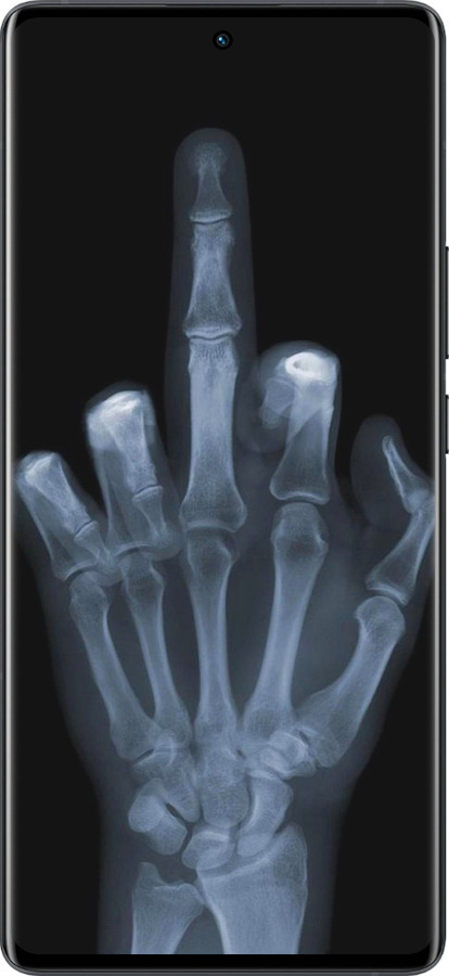 Силиконовый чехол Рука через рентген для Vivo X80 Pro - 1007u-2630 изображение 