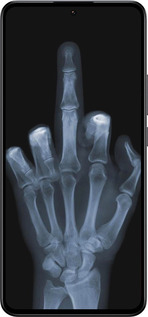 Силіконовий чехол Рука через рентген для Xiaomi 13T PRO - 1007u-3810 изображение 