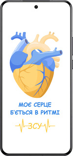 Силиконовый чехол Сердце v2 для Xiaomi 15 Ultra - 5296u-3967 изображение 