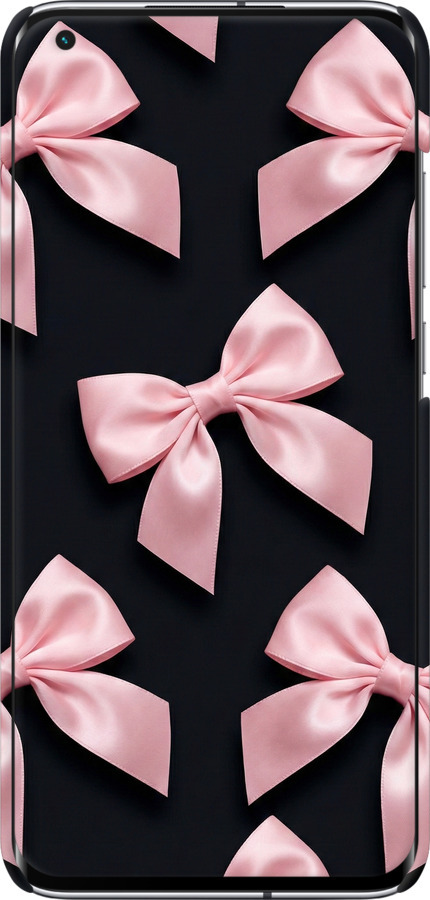 3D пластиковый матовый чехол Coquette Ribbons Dark Coquette для Xiaomi Mi 10 Ultra - 6767m-2064 изображение 