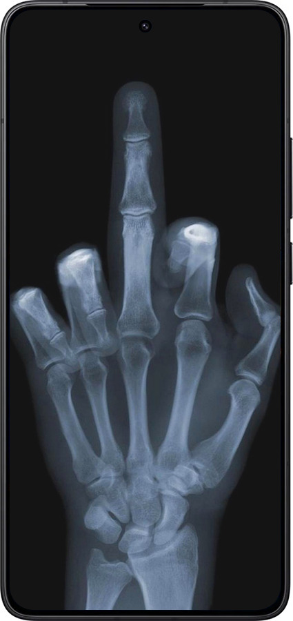 Силиконовый чехол Рука через рентген для Xiaomi POCO F7 Pro - 1007u-4085 изображение 