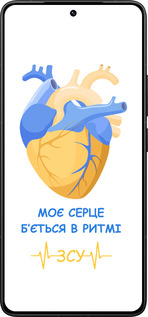 Силіконовий чехол Серце 2  для Xiaomi Redmi K80 Pro - 5296u-4145 изображение 