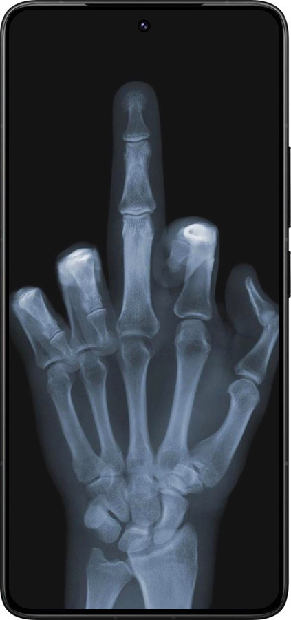 Силіконовий чехол Рука через рентген для Xiaomi Poco F7 Ultra - 1007u-4086 изображение 