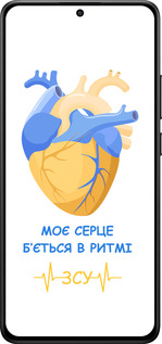 Силиконовый чехол Сердце v2 для Xiaomi Turbo 4 - 5296u-4013 изображение 