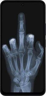 Силіконовий чехол Рука через рентген для Xiaomi Redmi 15 4G - 1007u-4136 изображение 