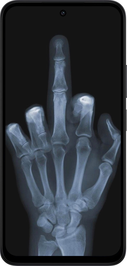 Силіконовий чехол Рука через рентген для Xiaomi Redmi 15 4G - 1007u-4136 изображение 