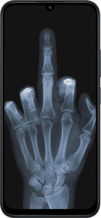 Силиконовый чехол Рука через рентген для Xiaomi POCO C85 4G - 1007u-4233 изображение 