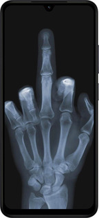 Силиконовый чехол Рука через рентген для Xiaomi Redmi A5 4G - 1007u-3926 изображение 