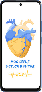 TPU чехол Сердце v2 для Xiaomi Redmi Note 11S 5G - 5296b-2890 изображение 