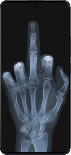 TPU чехол Рука через рентген для Xiaomi Redmi Note 13 Pro Plus 5g - 1007b-3400 изображение 