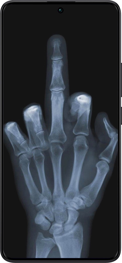 TPU чехол Рука через рентген для Xiaomi Redmi Note 13 Pro Plus 5g - 1007b-3400 изображение 