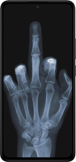 TPU чехол Рука через рентген для Xiaomi Redmi Note 14 4G - 1007b-3903 изображение 