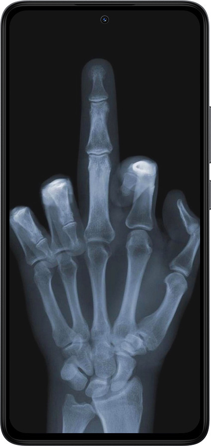 TPU чехол Рука через рентген для Xiaomi Redmi Note 14 4G - 1007b-3903 изображение 