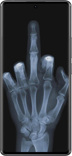 TPU чехол Рука через рентген для Xiaomi Redmi Note 14 Pro 4G - 1007b-3808 изображение 