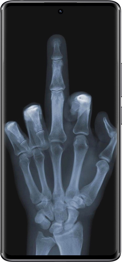 TPU чехол Рука через рентген для Xiaomi Redmi Note 14 Pro 4G - 1007b-3808 изображение 