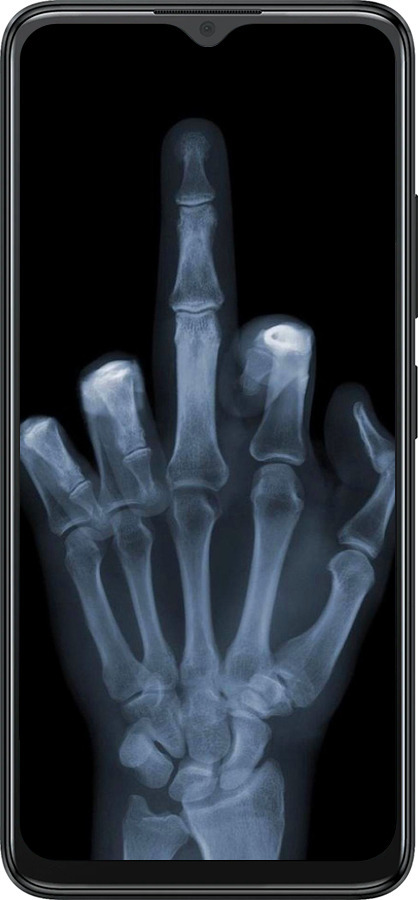 Силіконовий чехол Рука через рентген для ZTE Blade A34 - 1007u-3989 изображение 