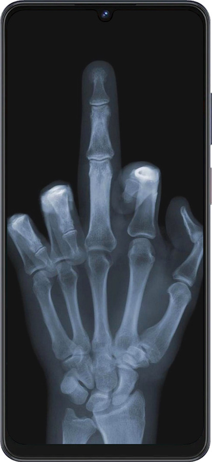 Силіконовий чехол Рука через рентген для ZTE Blade V50 Vita - 1007u-3813 изображение 