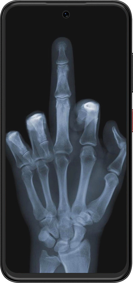 Силиконовый чехол Рука через рентген для ZTE Nubia V70 Design - 1007u-4084 изображение 