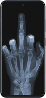 Силиконовый чехол Рука через рентген для ZTE Nubia V70 - 1007u-4083 изображение 