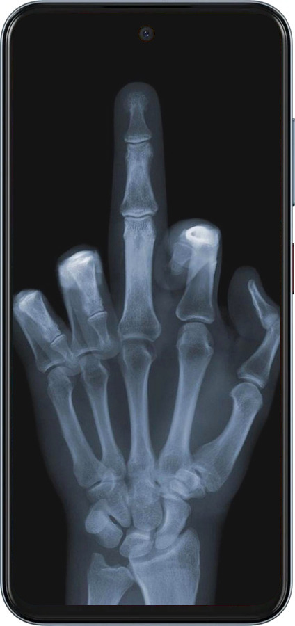 Силиконовый чехол Рука через рентген для ZTE Nubia V70 - 1007u-4083 изображение 